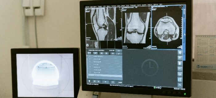 a scan of human bones 